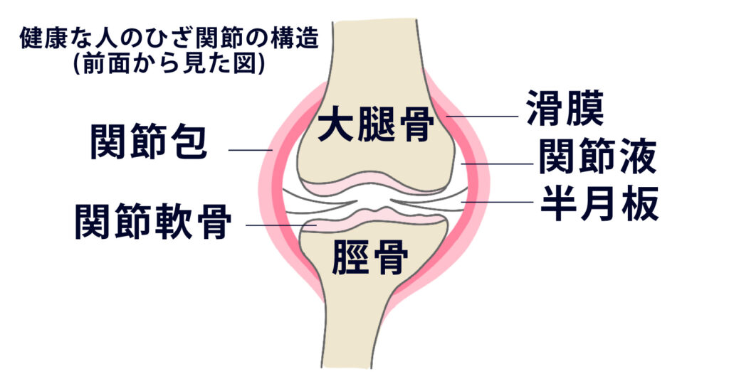 変形性膝関節症　治し方